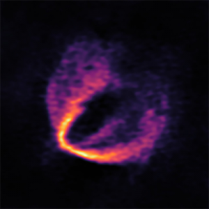 ALMA Discovers Trio of Infant Planets around Newborn Star