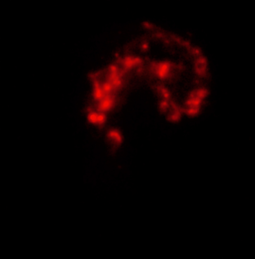 xray-chandra-antennae-IR.jpg